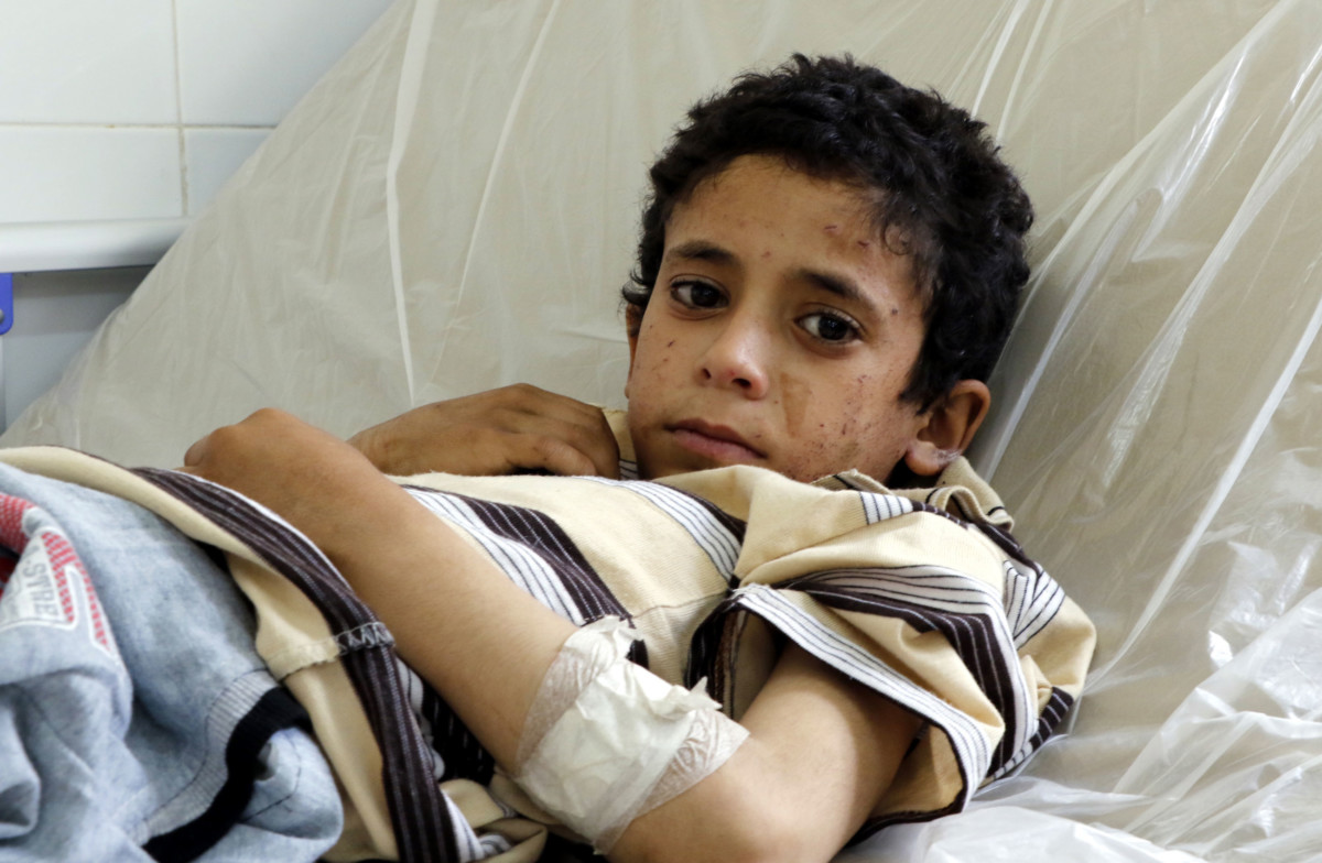 A Yemeni child receives medical treatment at a hospital in Saada, Yemen, on August 12, 2018, after he was injured by an airstrike hitting a bus he was riding.