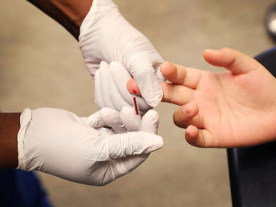 A person gets their hand pricked during a HIV test