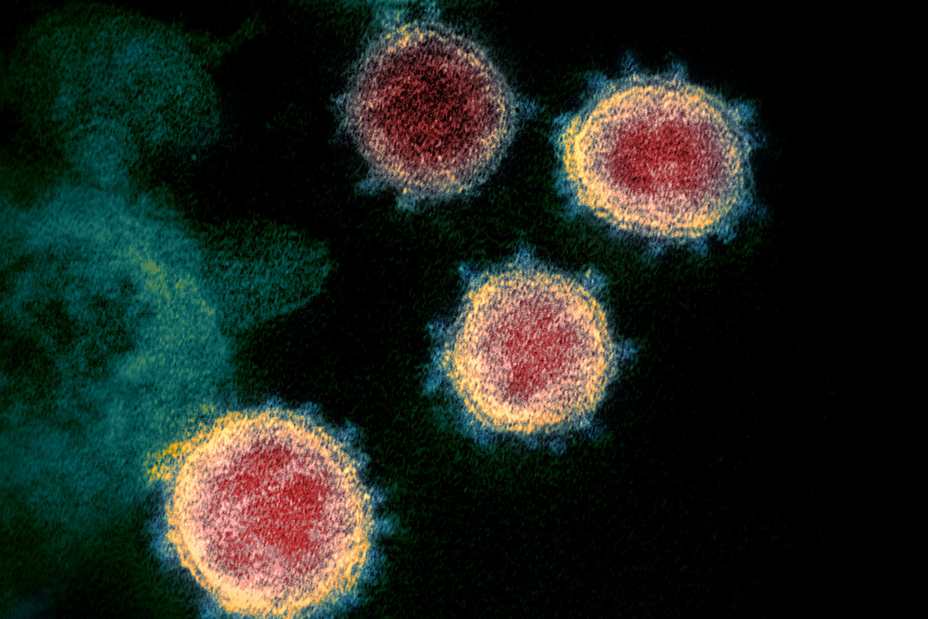 This transmission electron microscope image shows SARS-CoV-2 — also known as 2019-nCoV, the virus that causes COVID-19 — isolated from a patient in the U.S. Virus particles are shown emerging from the surface of cells cultured in the lab. The spikes on the outer edge of the virus particles give coronaviruses their name, crown-like.