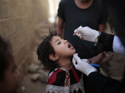 A small child receives a polio vaccine