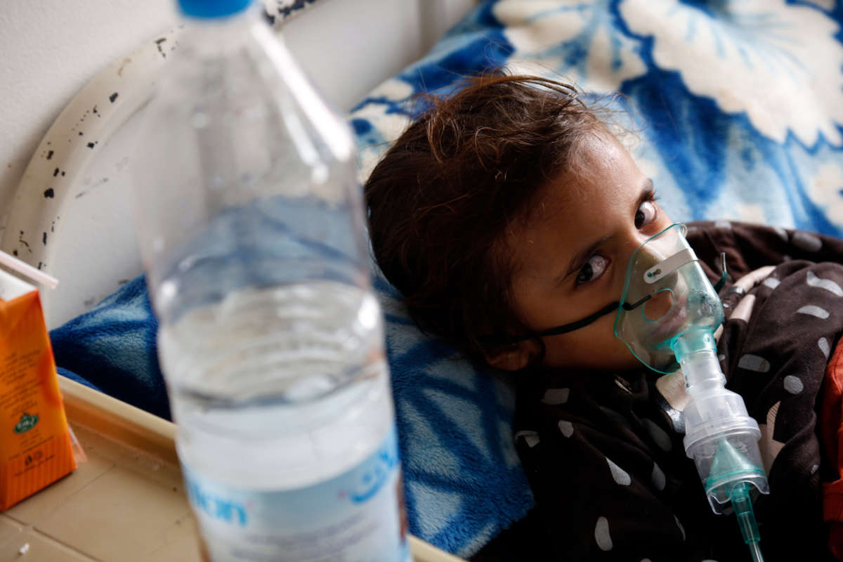 A Yemeni malnourished girl gets treatment at the malnutrition fighting department at Al-Sabeen hospital on August 10, 2021, in Sana'a, Yemen.