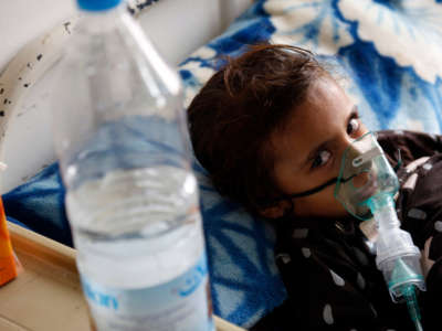 A Yemeni malnourished girl gets treatment at the malnutrition fighting department at Al-Sabeen hospital on August 10, 2021, in Sana'a, Yemen.