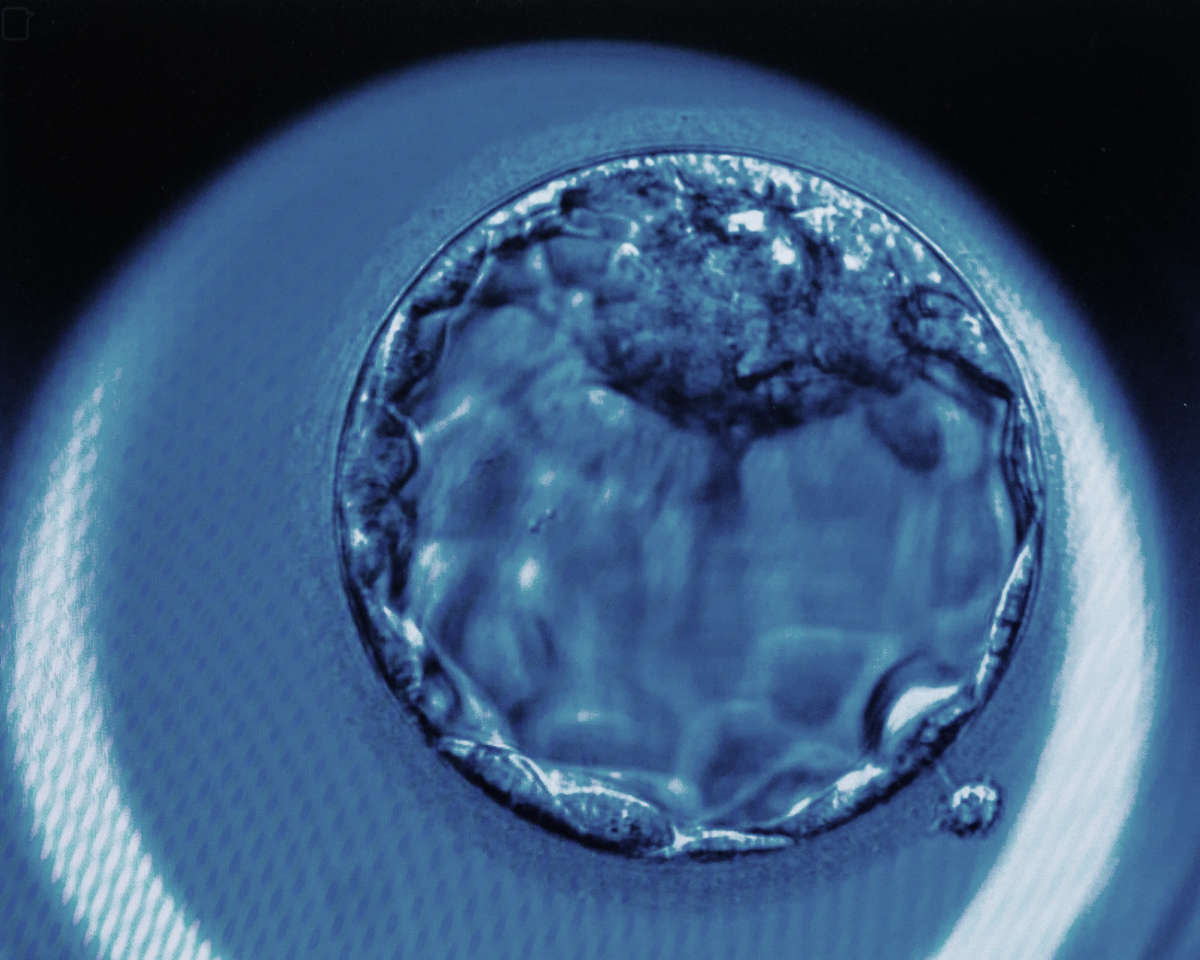 A microscopic image of a fertilized human egg cell