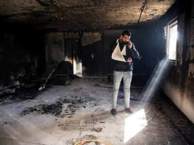 A man with his arm in a sling talks on a telephone while standing in the burnt remains of what was once an apartment