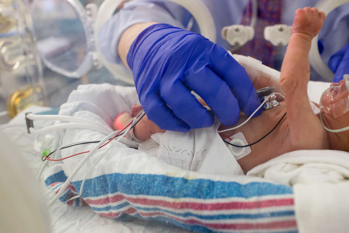 A premature infant is cared for by medical workers