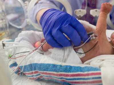 A premature infant is cared for by medical workers