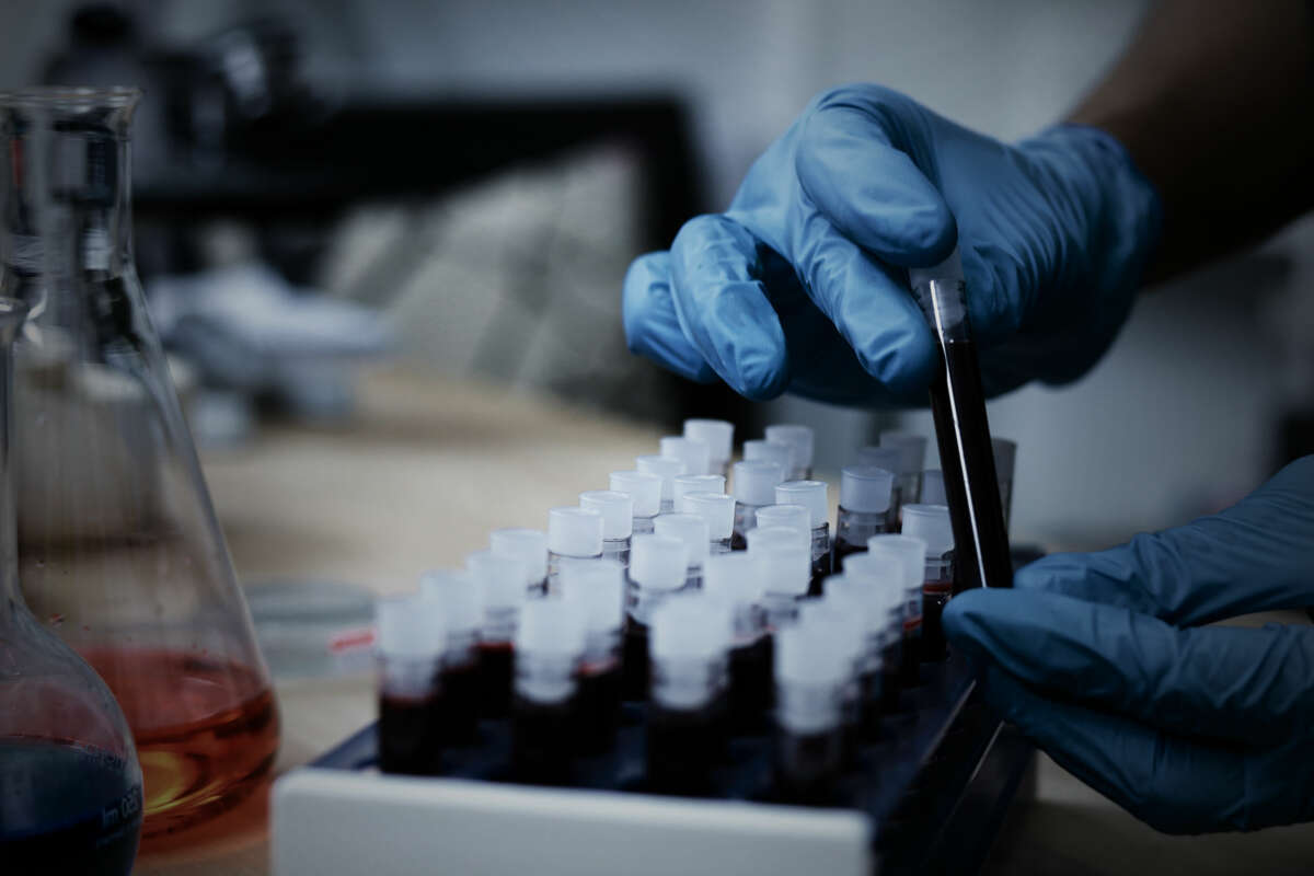 A pair of gloved hands holds a medical vial of blood