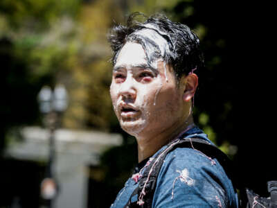 Andy Ngo is seen covered in an unknown substance thrown by unidentified counterprotesters on June 29, 2019, in Portland, Oregon.