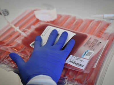 A lab technician prepares to thaw a blood bag before genetically modifying a patient's immune cells at a production laboratory unit of the Paoli-Calmettes Institute overall cancer care centre in Marseille, France, on March 8, 2019.