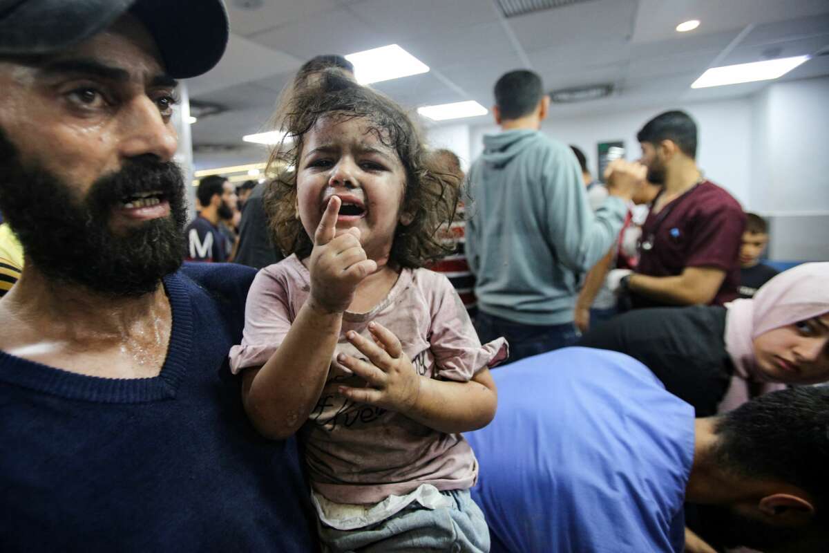 An injured toddler cries as she awaits treatment at the emergency ward of the al-Shifa hospital following an Israeli strike, in Gaza City, on November 5, 2023.