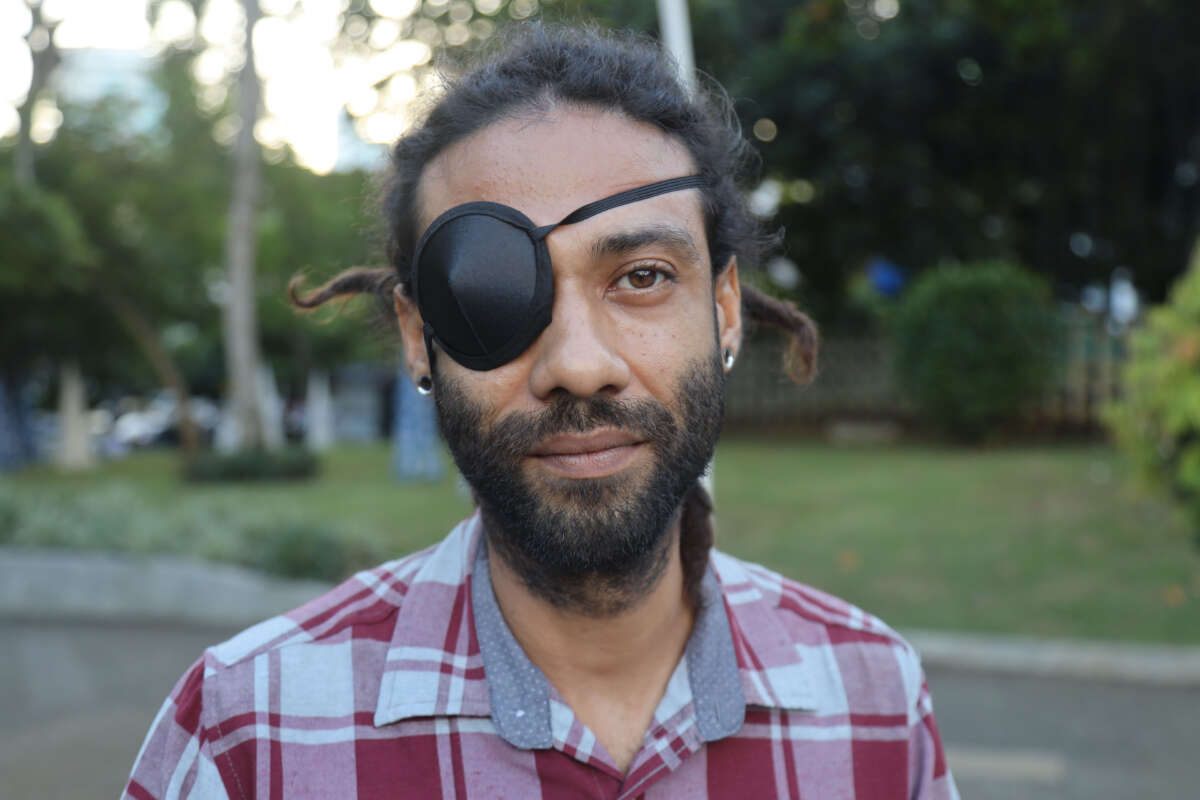 Aubrey Baxter, pictured in Panama City park, lost an eye after an officer fired rubber bullets at point-blank range at him during a protest.