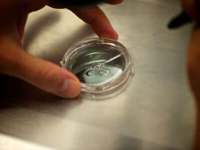 Human embryos are prepared for in vitro fertilization (IVF).