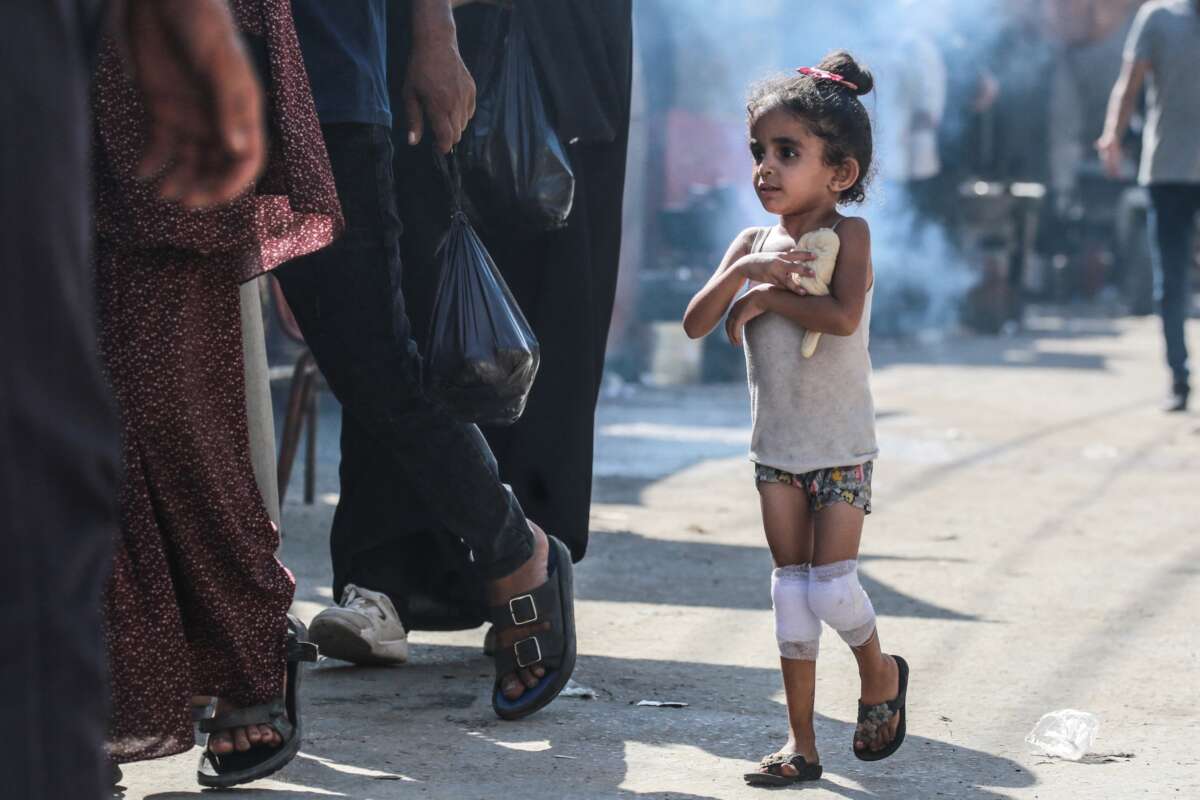 A Palestinian girl with her knees in bandages holds a piece of dough to her chest as she walks along a street in Deir al-Balah, in central Gaza Strip on June 13, 2024.