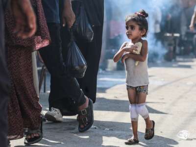 A Palestinian girl with her knees in bandages holds a piece of dough to her chest as she walks along a street in Deir al-Balah, in central Gaza Strip on June 13, 2024.