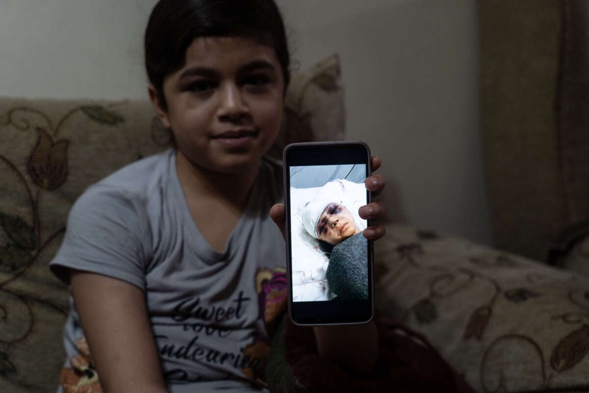 Saja shows a photo of the wounds she sustained when the family's home was targeted in an airstrike.