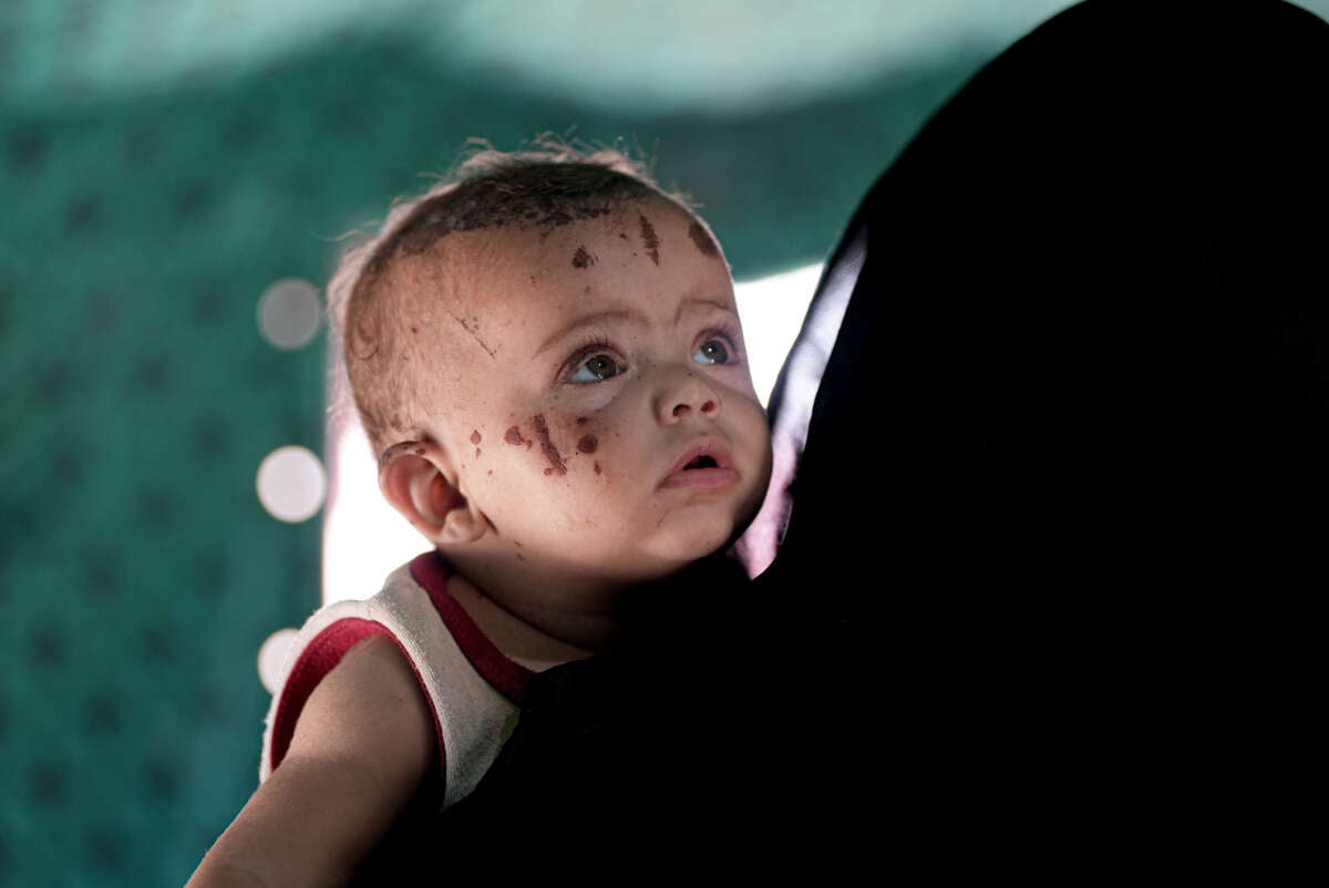 Three-month-old baby Rim is the sole survivor after an Israeli military attack on the home of the Abu Hiyye family in Khan Yunis, Gaza, on August 15, 2024.