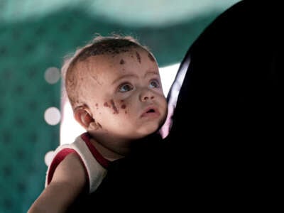 Three-month-old baby Rim is the sole survivor after an Israeli military attack on the home of the Abu Hiyye family in Khan Yunis, Gaza, on August 15, 2024.