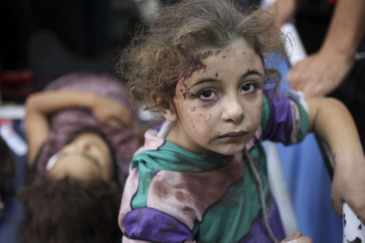 Children who were injured during an Israeli operation in the Jabalia refugee camp in the central Gaza Strip await treatment at Al-Ahli Arab hospital in Gaza City on October 21, 2024.