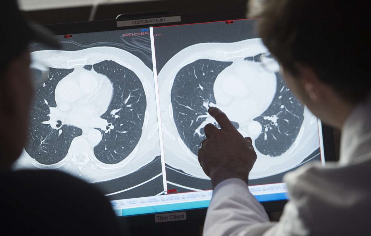 Dr. Christian Hinrichs shows patient Fred Janick, a survivor of metastatic cancer, the difference between his CT scan showing cancerous tumors and a clean scan after treatment, at the National Institutes of Health in Bethesda, Maryland, on February 8, 2018.