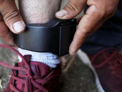 A migrant father from Guatemala, who chose not to be identified, demonstrates the ankle monitor he is required by ICE to wear 24 hours a day, on September 19, 2018, in Los Angeles, California.