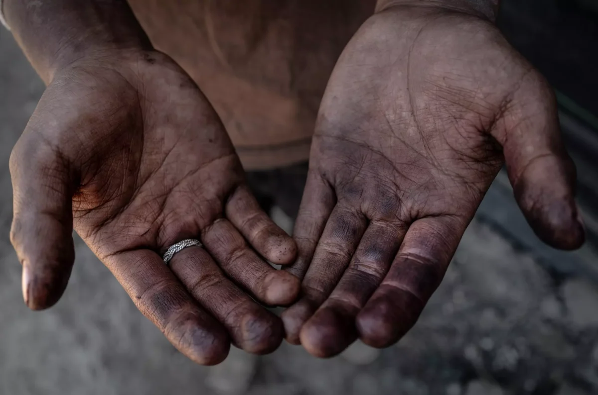 The hands of this 17-year-old strawberry picker are a testament to the physical nature of the work.