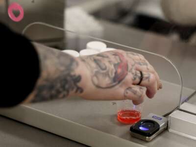 A woman reaches for a dose of methadone at the Behavioral Health Network opioid treatment clinic, in Orange, Massachusetts.