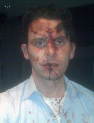 Matthew Clark following his 2010 beating by Chicago Police officer. An involved officer remembered Clark's eye color but did not recall seeing any visible injuries on his face. Clark and fellow complainant Greg Malandrucco's complaint remains open with the Independent Police Review Authority. (Courtesy of Matthew Clark)