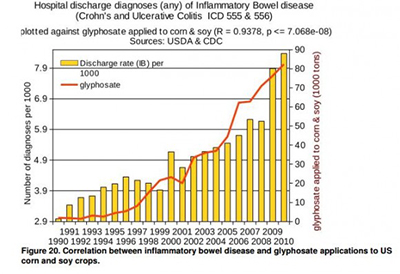 Inflammatory Bowel Disease