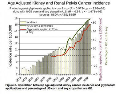 Kidney Cancer