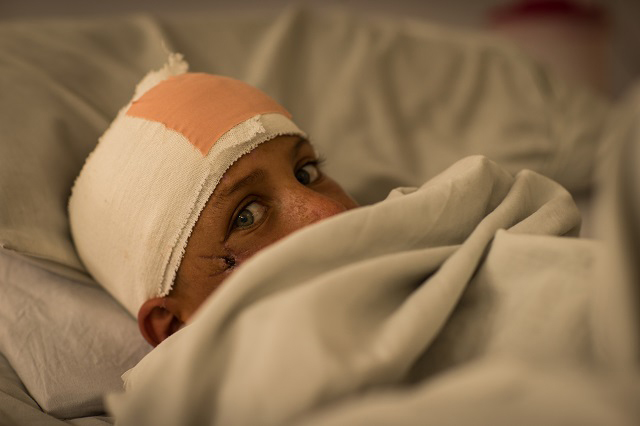 Abdullah, an 8-year-old from Ghazni province, lies in a ward inside Emergency Hospital in Kabul, Afghanistan, on May 2, 2017. Abdullah was wounded during a fight between the Afghan National Army (ANA) and the Taliban when a shell landed near his home. Abdullah lost an arm and has severe head trauma. (Photo: Ivan Armando Flores)