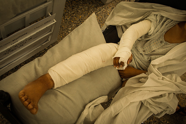 Barakatullah, a 10-year-old from Paktika Province, was riding on the back of his uncle's motorcycle when they drove over a land mine. In this photo from May 2, 2017, he sits in a wheelchair in Emergency Hospital in Kabul. He has major wounds on his right leg and left arm. Doctors at the hospital say he will need skin grafts. (Photo: Ivan Armando Flores)