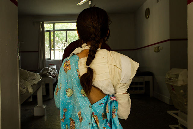 Nazbibi, a 9-year-old from Laghman Province, was playing with two other children and was caught in an IED explosion, according to doctors at Emergency Hospital in Kabul, Afghanistan, on May 2, 2017. (Photo: Ivan Armando Flores)