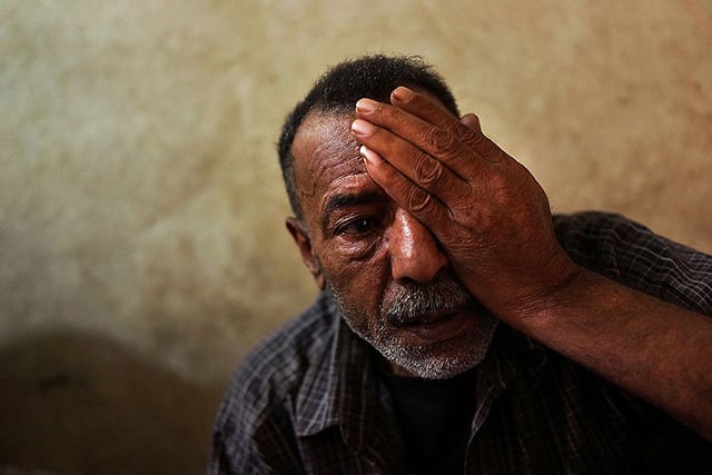  Syrian refugee Mohammed Hmayed holds a hand over an eye that was injured by shrapnel in a bombing in Syria in which he also lost a finger on November 13, 2013 in Beirut, Lebanon. Hmayed, who is from the city of Douma, Syria, lives in a two room apartment with 12 people. (Photo: Spencer Platt / Getty Images)