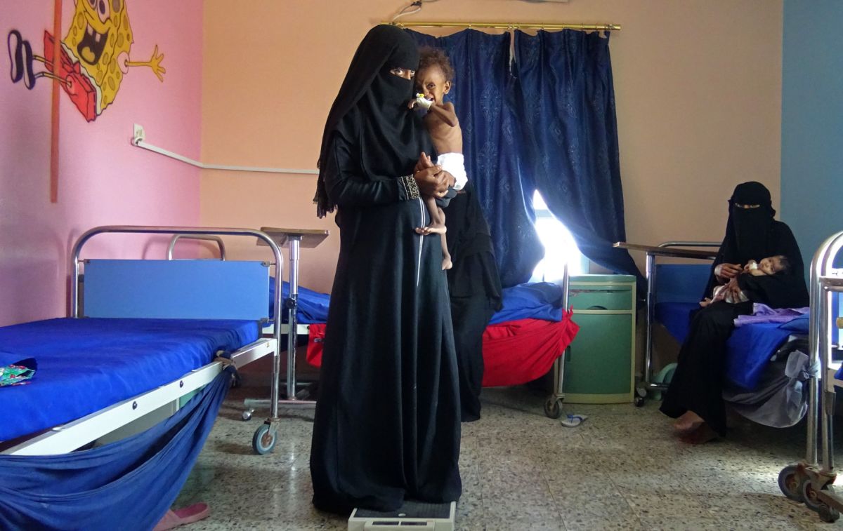 A Yemeni mother holds her malnourished child as they wait for treatments in a medical center in the village of Al Mutaynah in the Tuhayta province in western Yemen on November 29, 2018.