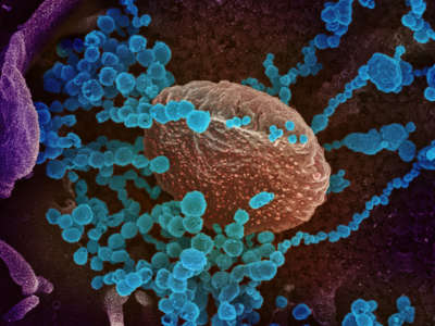 A scanning electron microscope image shows SARS-CoV-2 (round blue objects) emerging from the surface of cells cultured in the lab. SARS-CoV-2, also known as 2019-nCoV, is the virus that causes COVID-19. The virus shown was isolated from a patient in the U.S.