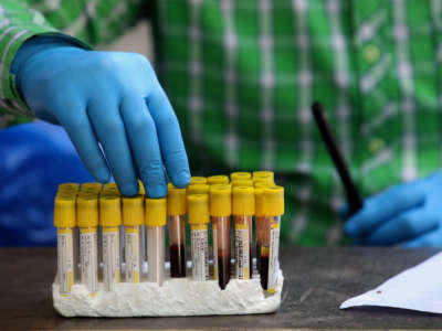 A health worker holds blood samples during a COVID-19 antibody test.