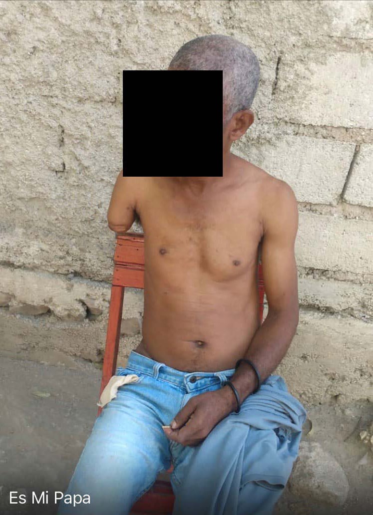 A photo of Daniel’s father taken after his deportation to Haiti, which corroborates that after Daniel initially fled Haiti, men working for the Pitit Desalin party severed his arm with a machete in Haiti.