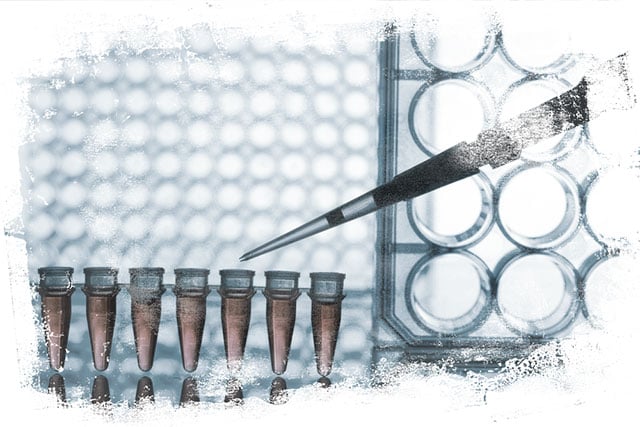 (Photo: PCR Strip Test and Black Rolled Ink via Shutterstock; Edited: LW / TO)