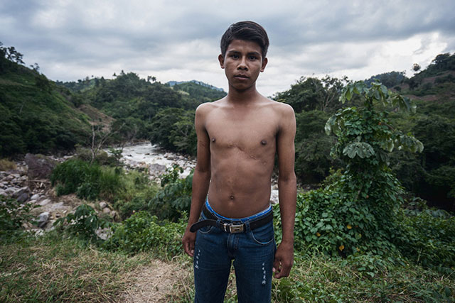 Indigenous Lenca youth Alan García was hit by a bullet when a soldier opened fire on and killed his father, Tomás García, in July 2014. (Photo: Giles Clarke, used with permission courtesy of Global Witness.)