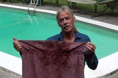 Peter Frizzell's medical notes show exposure to toxic chemicals. His towel is soaked in blood he coughed up. (Photo: Peter Frizzell)