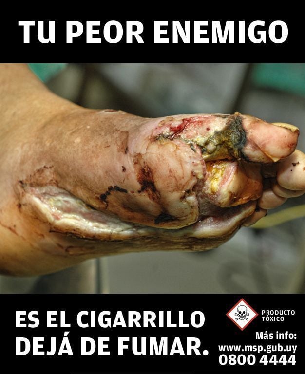 (Image: MSP, Ministerio de Salud Pública)